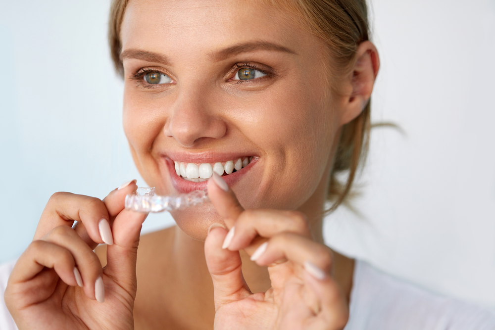 Invisalign fleet
